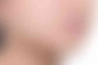 부산교정전문의