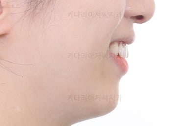 부산연산동부분교정