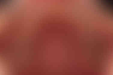 부산임플란트교정