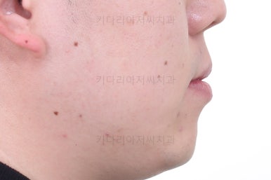 부산인비절라인