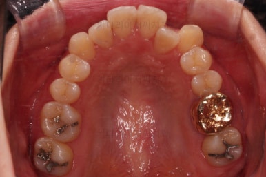 부산치아교정잘하는곳