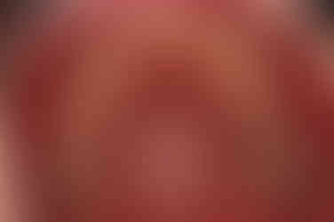 부산치아교정잘하는곳