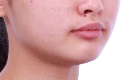 부산치아교정치과