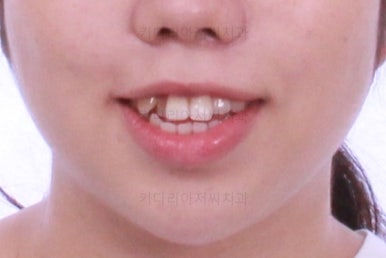 부산교정전문치과