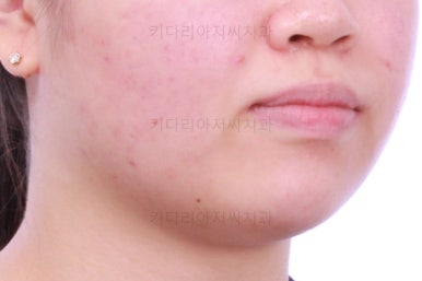 부산치아교정치과