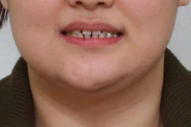 부산치아교정치과