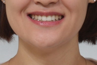 부산치아교정치과