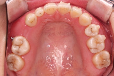 부산인비절라인