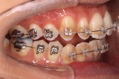 부산연제구교정