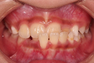 부산어린이교정