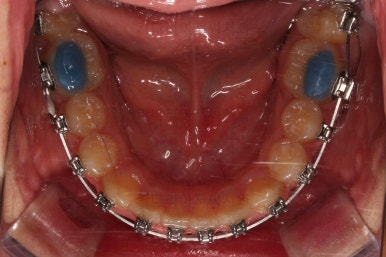 부산청소년교정