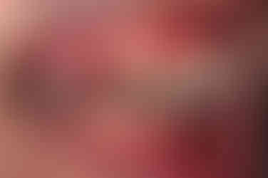 부산교정치과추천