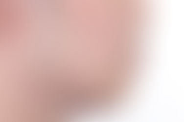 부산앞니교정