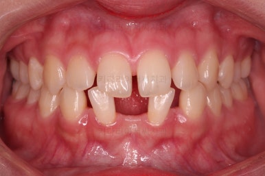 부산교정치과추천