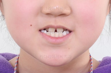 부산초등학생교정