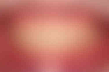 부산돌출입교정