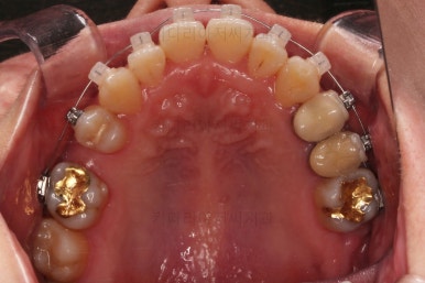 부산연산동치과