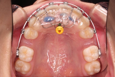 부산치아교정치과