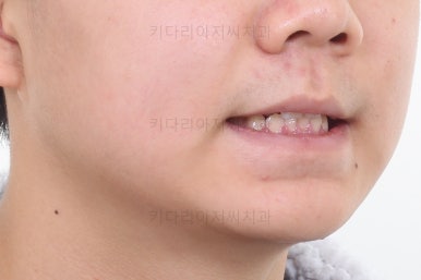 부산청소년교정