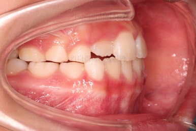 부산어린이교정