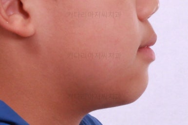 부산어린이교정