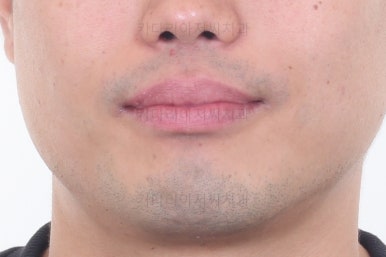 부산교정치과추천