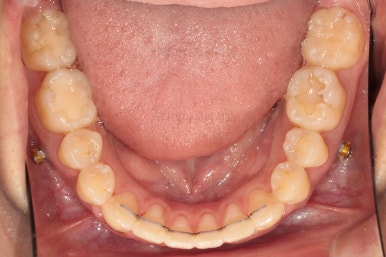 부산치아교정치과