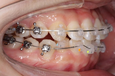연산동교정치과
