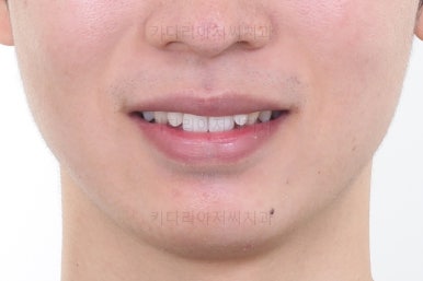 부산연제구교정