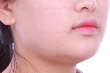 부산교정치과추천