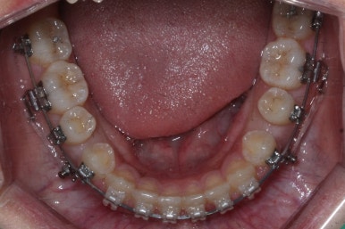 부산치아교정치과