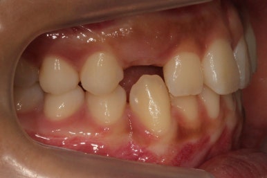 부산연산동청소년교정