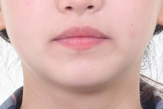 부산치아교정잘하는곳