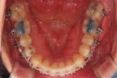 부산연제구교정