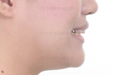 연산동치아교정치과