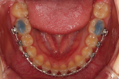 부산교정전문의