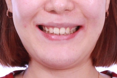 연산동교정치과