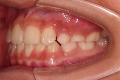 부산어린이교정