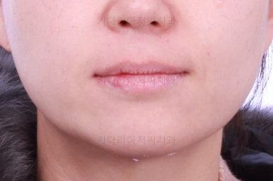 부산연산동치과