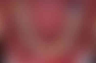 부산덧니교정