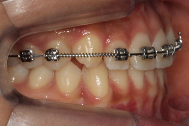 부산연산동청소년교정