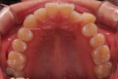 부산인비절라인