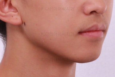 부산교정치과추천