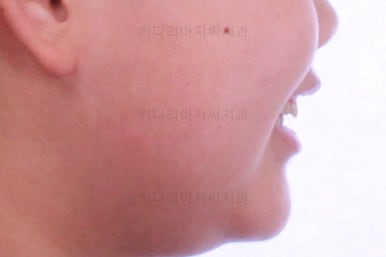 부산교정치과추천