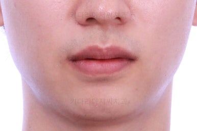 부산연제구교정