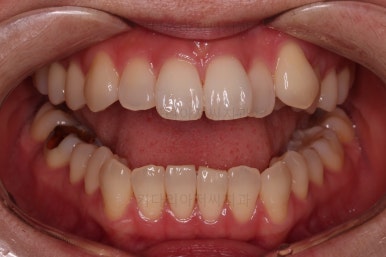 부산인비절라인