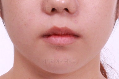 부산교정전문치과