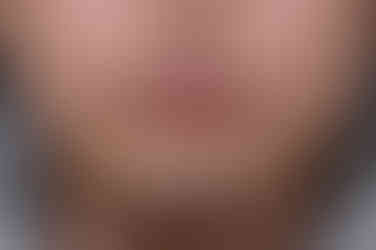 부산주걱턱교정