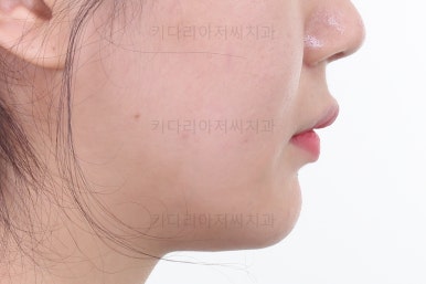 연산동교정치과