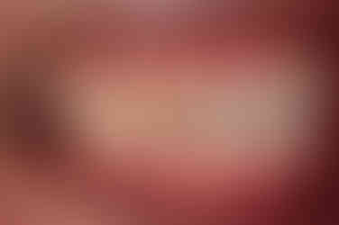 연산동임플란트